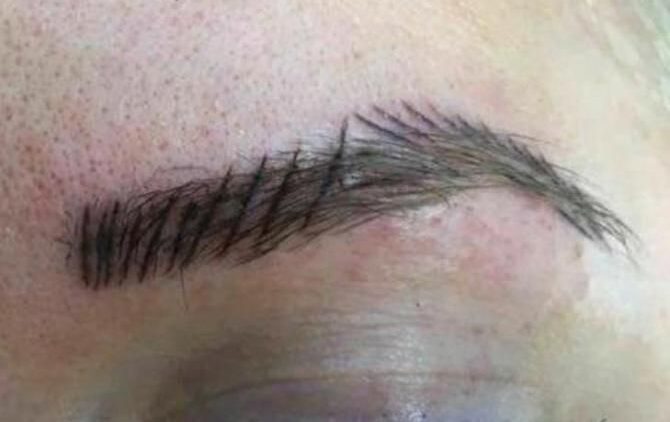 ¿Microblading mal hecho? Qué hacer si tus cejas no quedaron como ...