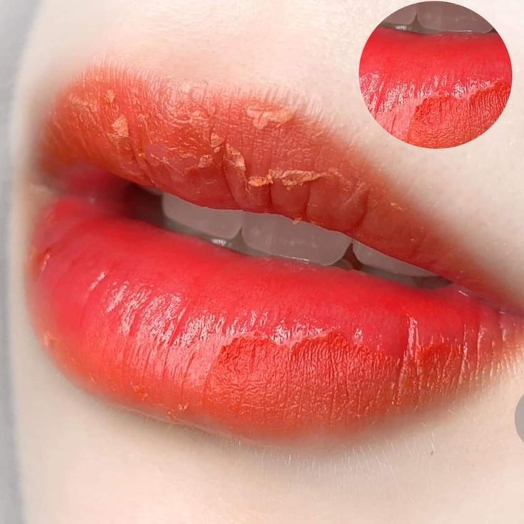 Cicatrizacion de labios