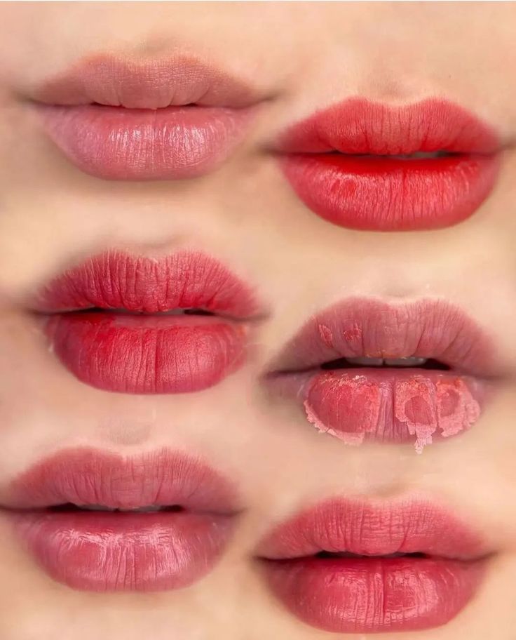 Proceso de cicatrizacion